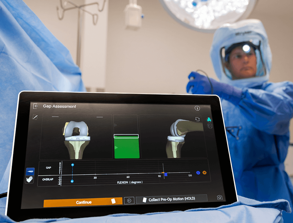 computer screen showing knee joint and a helmeted surgeon behind