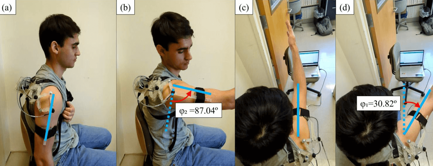 image of boy with device on arm